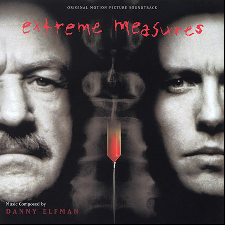 Обложка к альбому - Крайние меры / Extreme Measures
